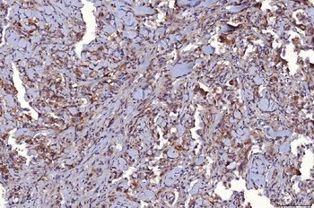 Anti-CD147/Emmprin Antibody (monoclonal, 6H2B2)