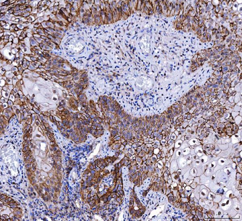 Anti-CD147/Emmprin Antibody (monoclonal, 6H2B2)