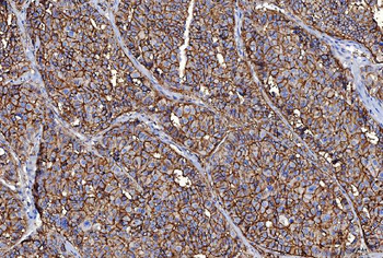 Anti-CD147/Emmprin Antibody (monoclonal, 6H2B2)