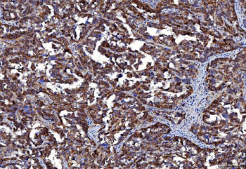 Anti-CD147/Emmprin Antibody (monoclonal, 6H2B2)