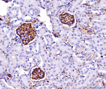 Anti-CD147/Emmprin Antibody (monoclonal, 6H2B2)