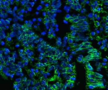 Anti-CD147/Emmprin Antibody (monoclonal, 7H5E7)