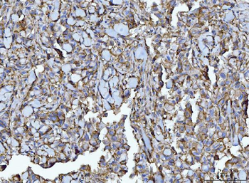 Anti-CD147/Emmprin Antibody (monoclonal, 7H5E7)