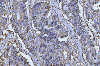 Anti-CD147/Emmprin Antibody (monoclonal, 7H5E7)