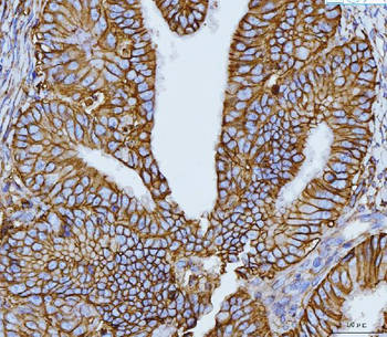 Anti-CD147/Emmprin Antibody (monoclonal, 7H5E7)
