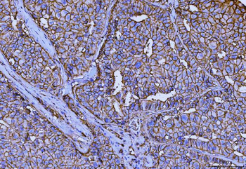 Anti-CD147/Emmprin Antibody (monoclonal, 7H5E7)