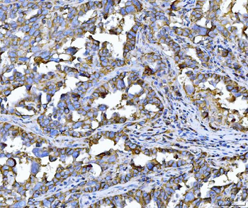 Anti-CD147/Emmprin Antibody (monoclonal, 7H5E7)
