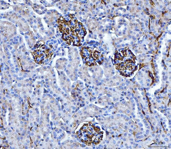 Anti-CD147/Emmprin Antibody (monoclonal, 7H5E7)