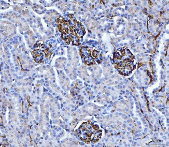 CD147/Emmprin Antibody (monoclonal, 7H5E7)