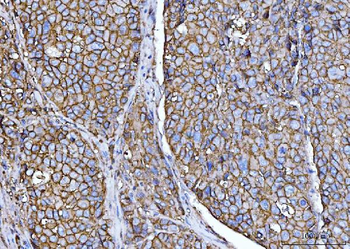 Anti-CD147/Emmprin Antibody (monoclonal, 3B13G7)