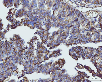 Anti-CD147/Emmprin Antibody (monoclonal, 3B13G7)