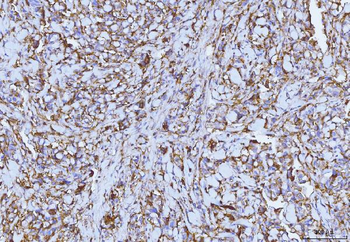 Anti-CD147/Emmprin Antibody (monoclonal, 3B13G7)