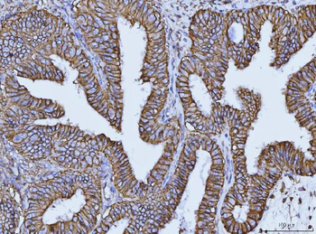 Anti-CD147/Emmprin Antibody (monoclonal, 3B13G7)