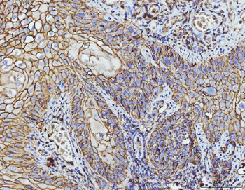 Anti-CD147/Emmprin Antibody (monoclonal, 3B13G7)