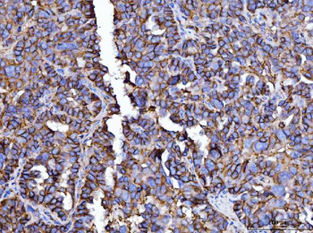 Anti-CD147/Emmprin Antibody (monoclonal, 3B13G7)