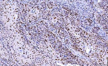 Cdk2 Mouse Monoclonal Antibody