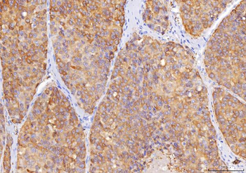 Anti-Sorbitol Dehydrogenase/SORD Antibody (monoclonal, 12B10G2)