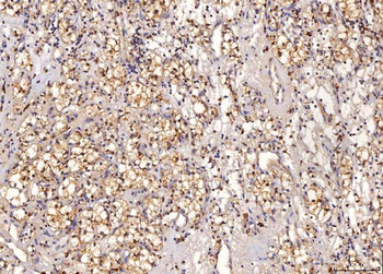 Anti-Sorbitol Dehydrogenase/SORD Antibody (monoclonal, 12B10G2)