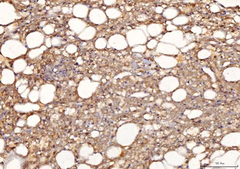 Anti-Sorbitol Dehydrogenase/SORD Antibody (monoclonal, 12B10G2)