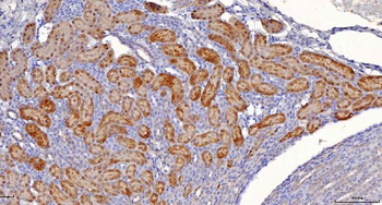 Anti-Sorbitol Dehydrogenase/SORD Antibody (monoclonal, 12B10G2)
