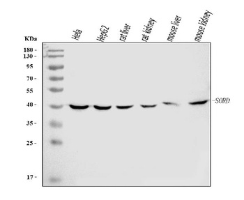 Sorbitol Dehydrogenase/SORD Antibody (monoclonal, 12B10G2)