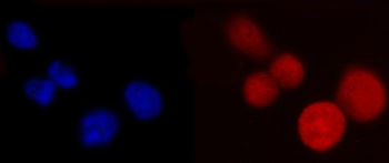 Anti-PCBP2/hnRNP E2 Antibody (monoclonal, 4B9C7)