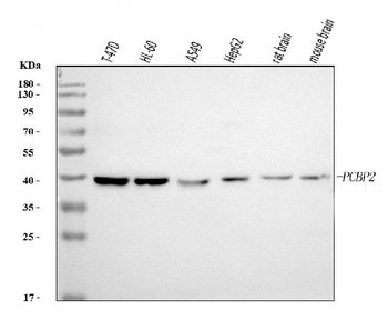 Anti-PCBP2/hnRNP E2 Antibody (monoclonal, 4B9C7)