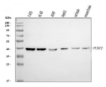 PCBP2/hnRNP E2 Antibody (monoclonal, 4B9C7)