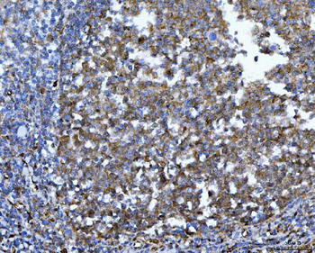 Anti-YWHAE Antibody (monoclonal, 3G11G2)