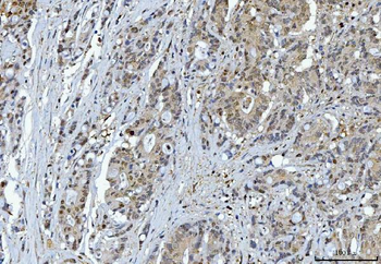 Anti-YWHAE Antibody (monoclonal, 3G11G2)
