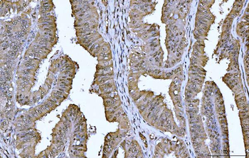 Anti-YWHAE Antibody (monoclonal, 3G11G2)