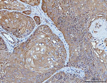 Anti-YWHAE Antibody (monoclonal, 3G11G2)