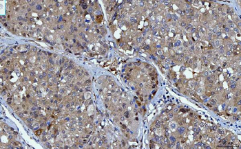Anti-YWHAE Antibody (monoclonal, 3G11G2)