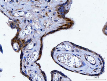 Anti-YWHAE Antibody (monoclonal, 3G11G2)