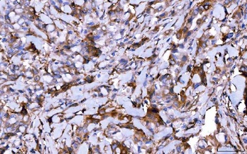 HGS Antibody (monoclonal, 4B7E2)