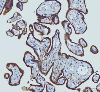 HGS Antibody (monoclonal, 6C2E1)