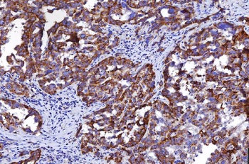 HGS Antibody (monoclonal, 6C2E1)