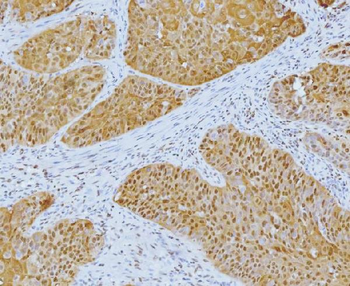 Anti-YY1 Antibody (monoclonal, 3F3E7)