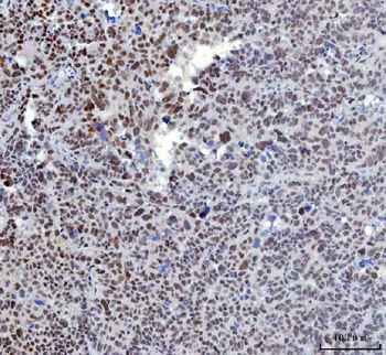 Anti-YY1 Antibody (monoclonal, 3F3E7)