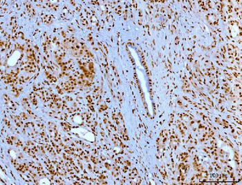 Anti-YY1 Antibody (monoclonal, 3F3E7)