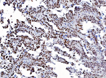Anti-YY1 Antibody (monoclonal, 3F3E7)