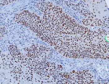 Anti-YY1 Antibody (monoclonal, 2C10F9)
