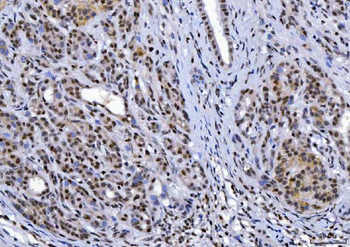 Anti-YY1 Antibody (monoclonal, 2C10F9)