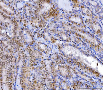 Anti-YY1 Antibody (monoclonal, 2C10F9)