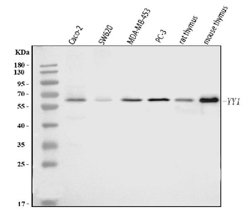 Anti-YY1 Antibody (monoclonal, 2C10F9)