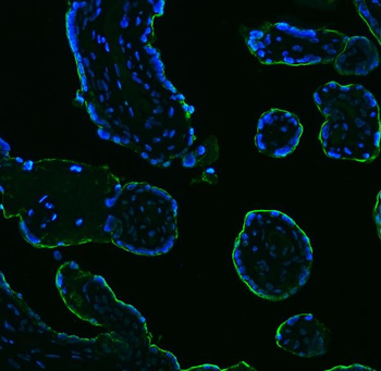 Anti-ALPP Antibody (monoclonal, 6C7G3)