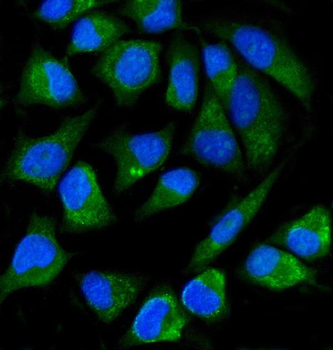 Anti-ALPP Antibody (monoclonal, 6C7G3)