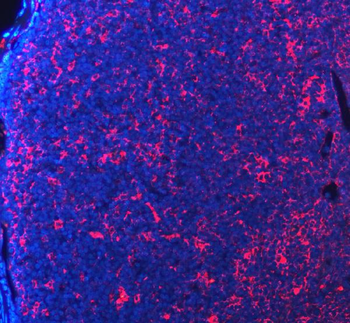 Anti-PD-1/PDCD1 Antibody