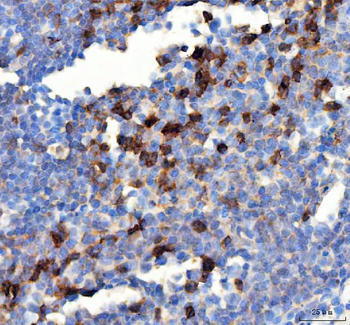 Anti-PD-1/PDCD1 Antibody