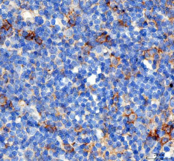 Anti-PD-1/PDCD1 Antibody